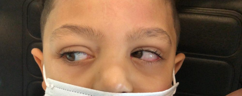 University Hospital Of Sharjah Successfully Performs Surgery On 4-Year-Old Patient To Treat Rare Vertical Squint Condition